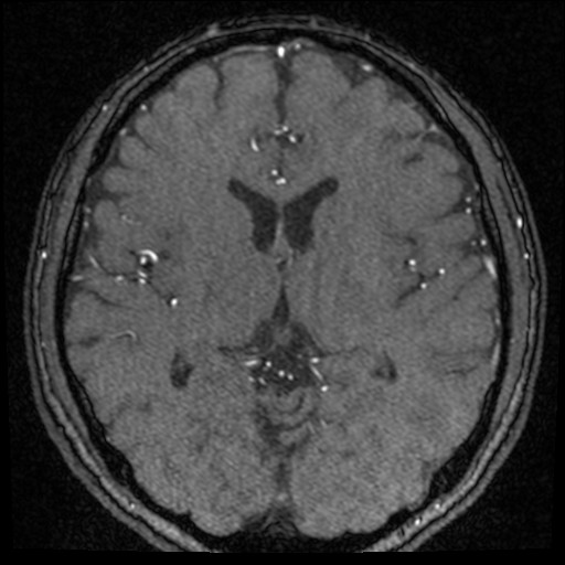 Click on the Serie image to view the images of VILLANUEVA, WILLIAM A.